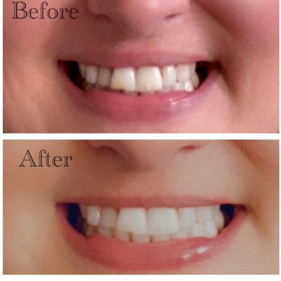 Whitening Toothpaste - Picture 2 of 9